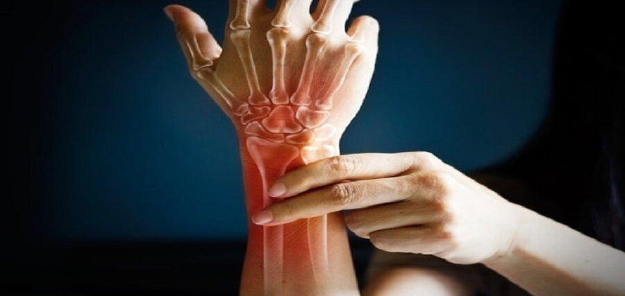 5 روش طبیعی برای داشتن استخوان های مقاوم 5 روش طبیعی برای داشتن استخوان های مقاوم